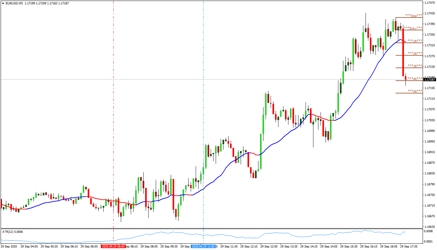 EURUSDM5.09292020.png